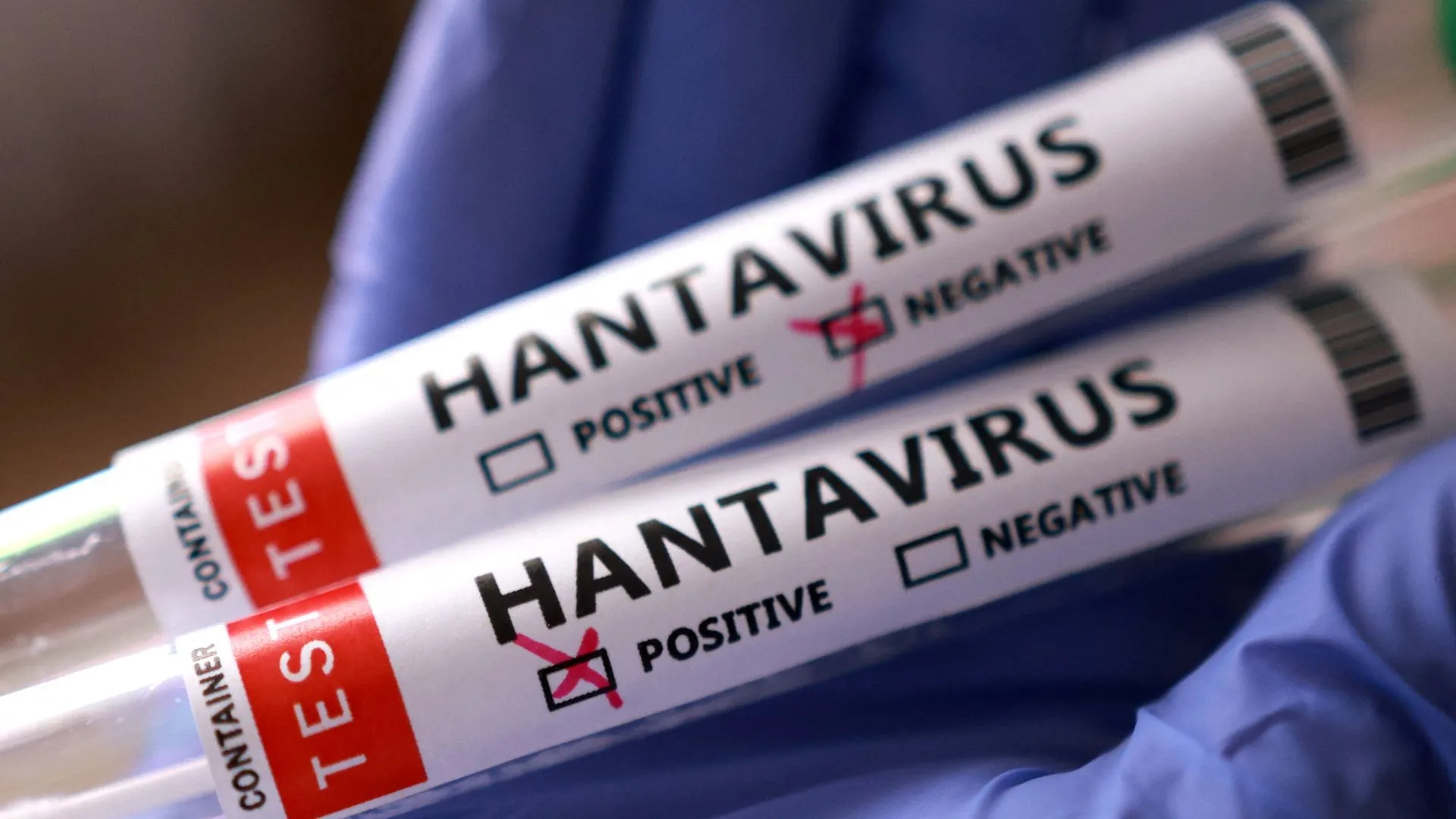 Imagen representativa del hantavirus